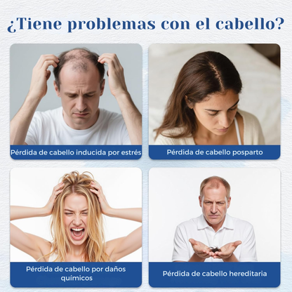 Sérum Capilar de Romero 10 ml Concentrado